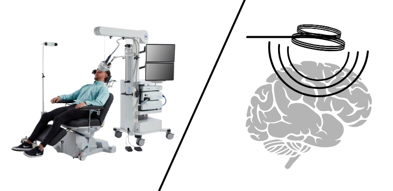 Revolutionary Treatment TMS Therapy